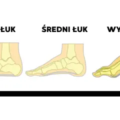 Ilustracja pokazuje trzy rodzaje podbicia stopy: niski, średni i wysoki łuk. Strzałka wskazuje progresję od płaskiej stopy do wysokiego podbicia.
