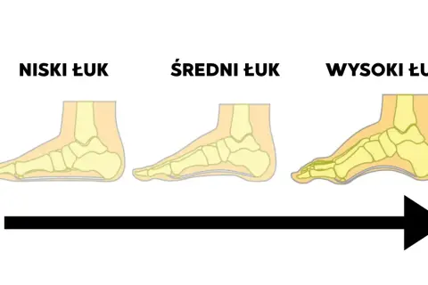 Ilustracja pokazuje trzy rodzaje podbicia stopy: niski, średni i wysoki łuk. Strzałka wskazuje progresję od płaskiej stopy do wysokiego podbicia.