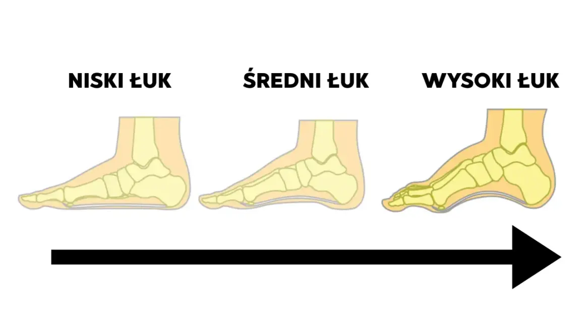 Ilustracja pokazuje trzy rodzaje podbicia stopy: niski, średni i wysoki łuk. Strzałka wskazuje progresję od płaskiej stopy do wysokiego podbicia.