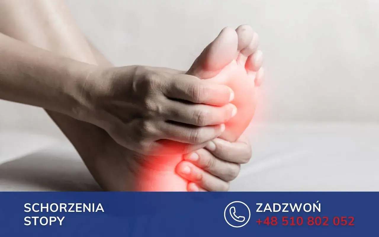 Dłoń uciska bolesne przodostopie, sugerując ból przodostopia przy chodzeniu.